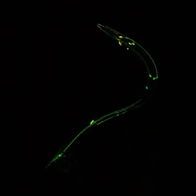The silhouette of a roundworm is highlighted in green against a black background.