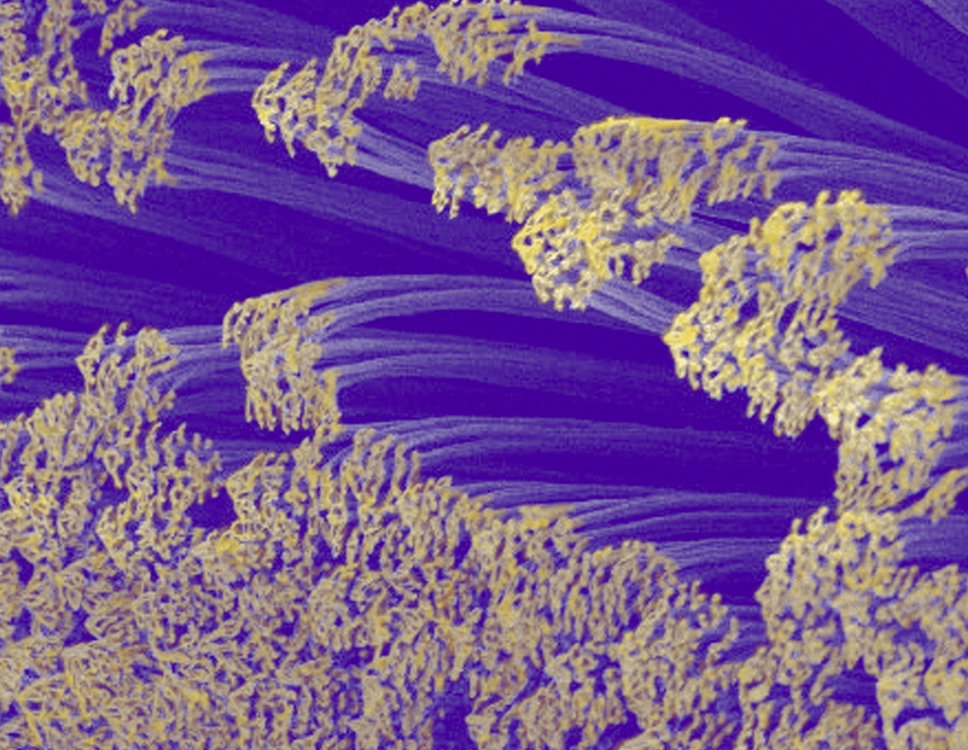 Microscopic image of gecko toe hairs that look like purple tree stalks with yellow branches at the top, which are the hairs splitting into smaller hairs that fray into spatula-shaped structures. The hair roots appear green.