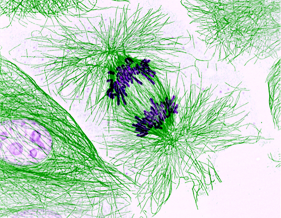 Pig cell in the process of dividing. Chromosomes (purple, shorter, center) and the cell skeleton (green, fibrous, outer).