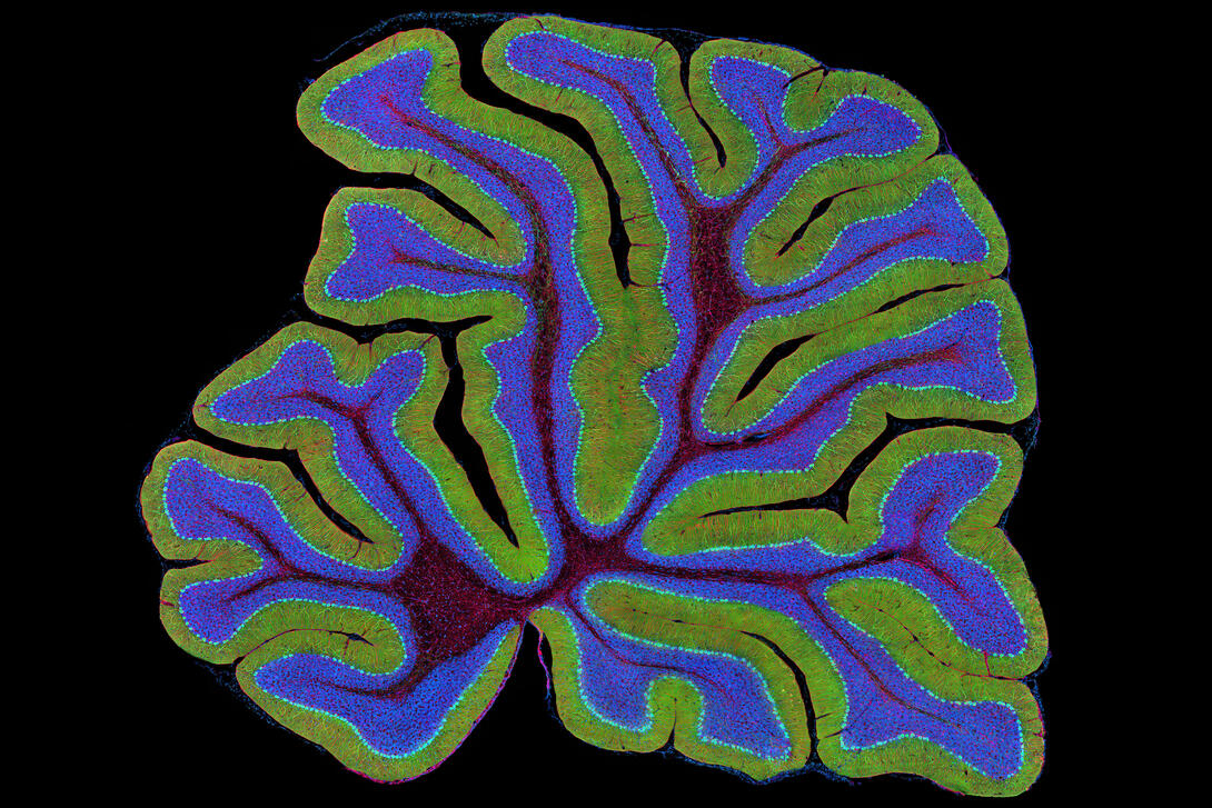 Cerebellum: the brain's locomotion control center | National
