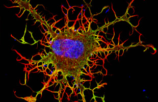 Fibroblast