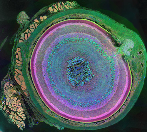 Mammalian eye