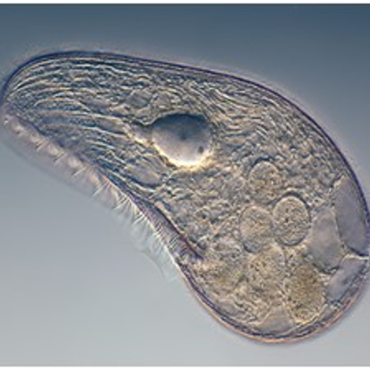 Blepharisma