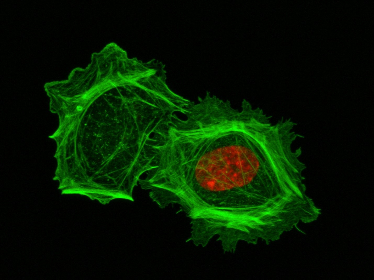 A closeup of two human cells with the cells dyed green and the necleaus dyed red.