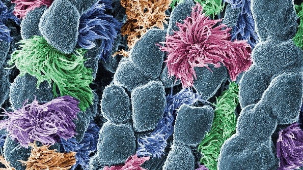 A mosaic of round blue shapes and fuzzy green, purple, orange, and pink shapes.
