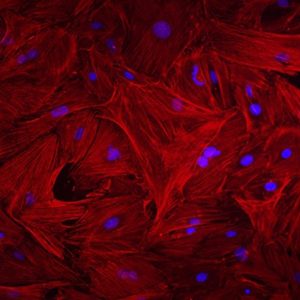 Many oblong-shaped red structures packed close together with a blue dot inside some of them. Click to view in NIGMS image gallery.
