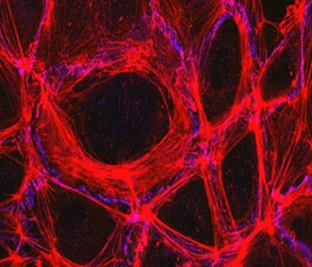 A red, honeycomb-like structure with blue spots throughout. Click to view in NIGMS image gallery.