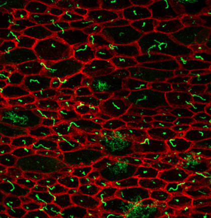 Primary cilia on cells depicted as a red honeycomb-like structure with small green squiggles throughout.
