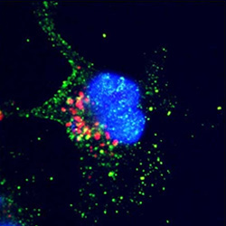 Stained cell showing apoptosis