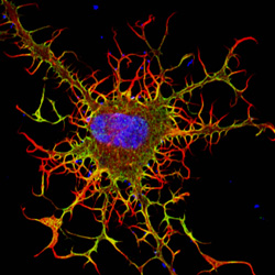Fibroblast