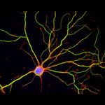 Hippocampal neuron in culture.