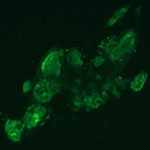 Stem cells. Credit: Julie Mathieu, University of Washington.