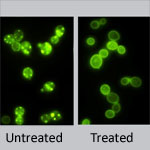 (Left) Untreated yeast cells, (Right) Treated yeast cells. Credit: Daniel Tardiff, Whitehead Institute.